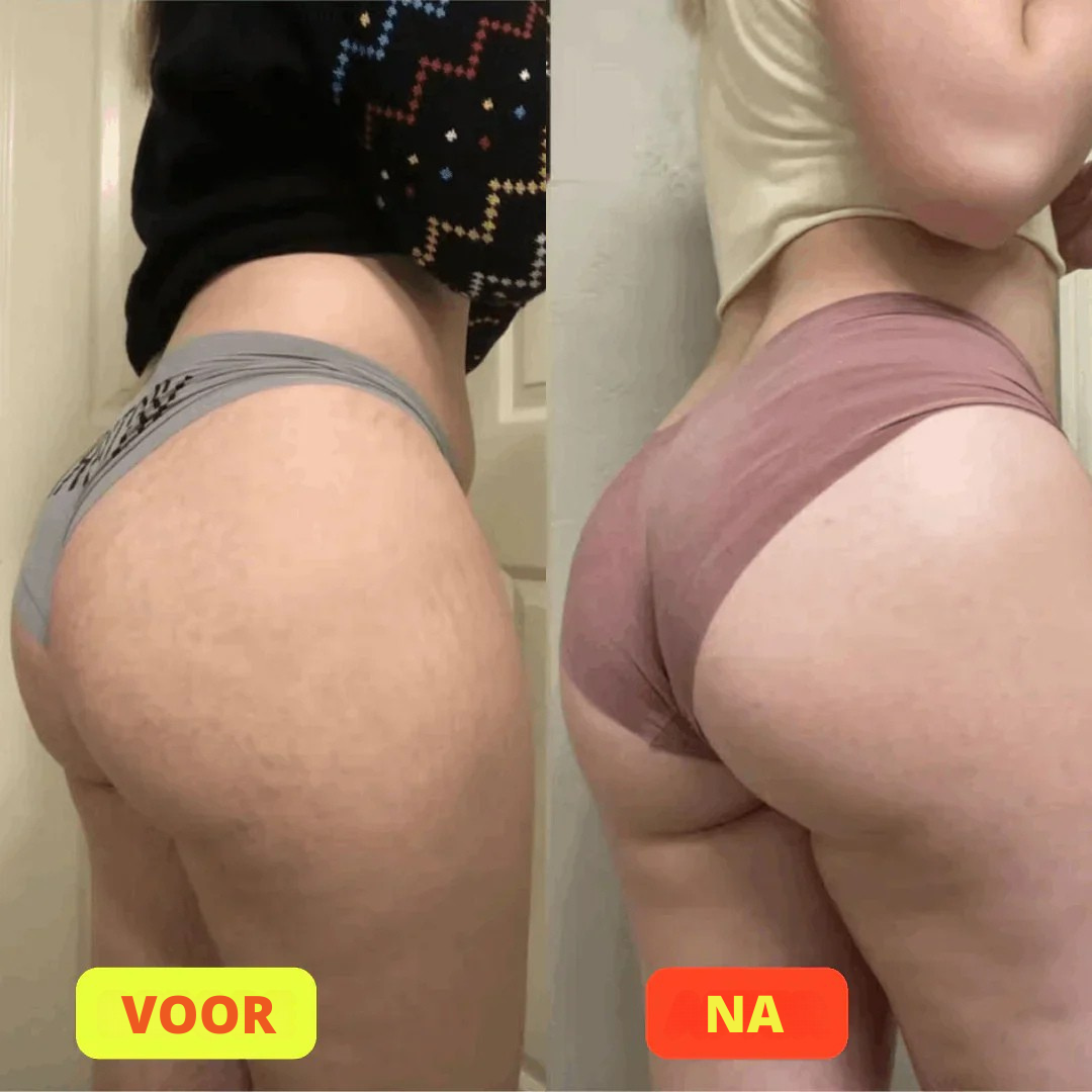 GlutePro™ Max – Ultimate Booty Trainer for Firmer, Stronger Glutes